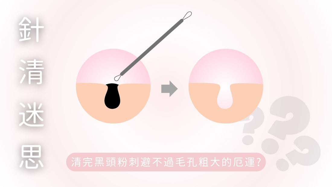 針清迷思-清完黑頭粉刺避不過毛孔粗大的厄運?