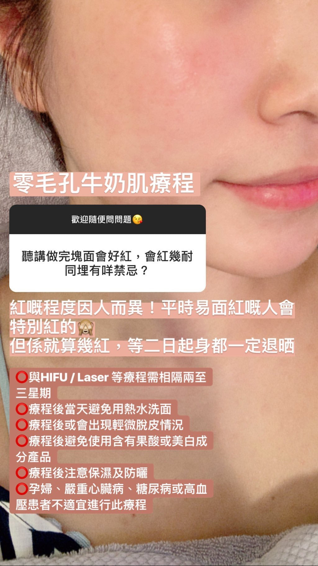 零毛孔牛奶肌(單次)